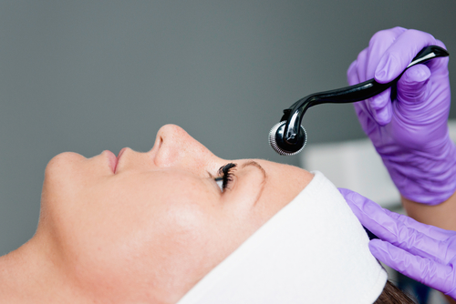 Collagen induction therapy at beauty salon
